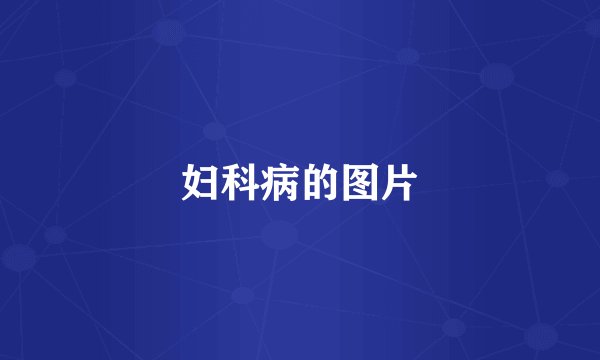 妇科病的图片