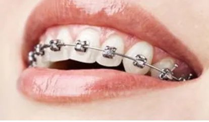 西安哪个医院做牙科整形比较好?附价格表一览