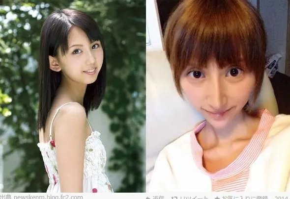 娱乐圈有哪些本来就长得很好看却还整容的明星？