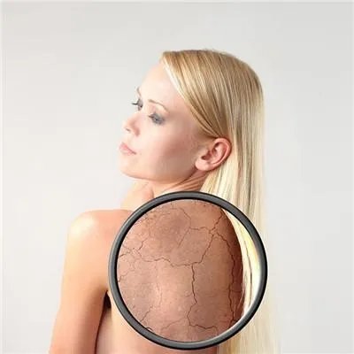 中医怎么治疗过敏性紫癜