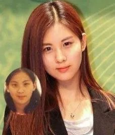 徐贤真整容 图片：徐贤真尴尬颁奖典礼