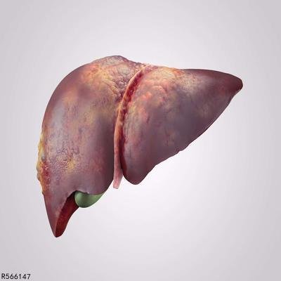 肝衰竭严重怎么办 四招有效治疗严重肝衰竭