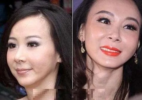 娱乐圈有哪些本来就长得很好看却还整容的明星？