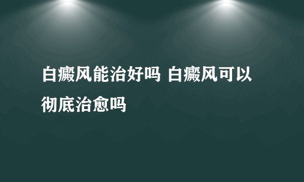 白癜风能治好吗 白癜风可以彻底治愈吗