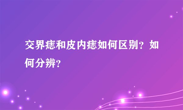 交界痣和皮内痣如何区别？如何分辨？