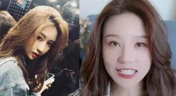 网红温精灵被吐槽整容失败，你还知道哪些整容失败的网红？