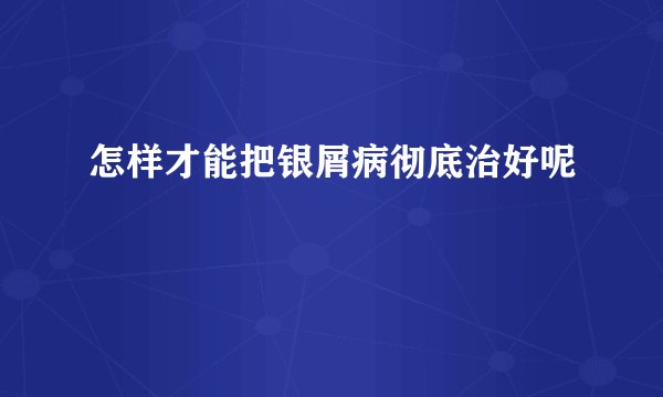 怎样才能把银屑病彻底治好呢