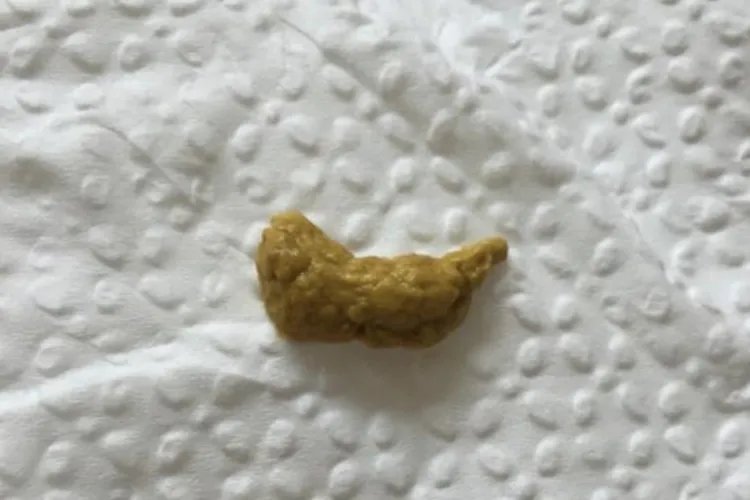 11个月宝宝正常大便图