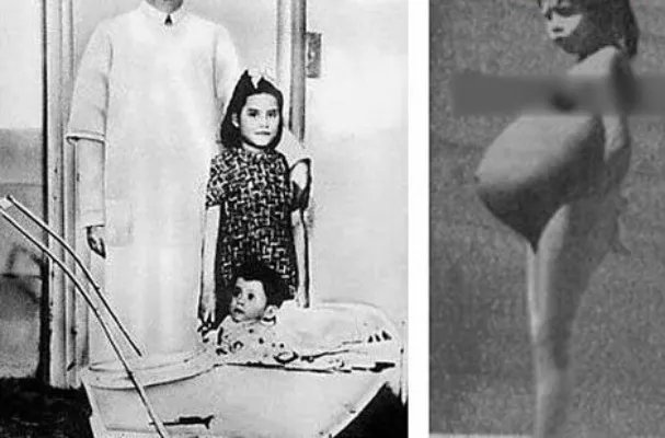 世界上最年轻的一对父母：年仅五岁你信吗？