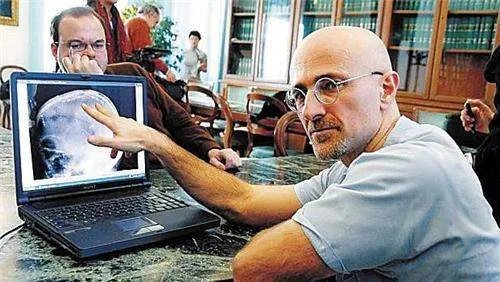 世界首例“猴子换头”手术，共耗资7000万，成功后猴子活了多久？