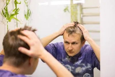 脂溢性脱发能用生姜吗 脂溢性脱发实用小妙招揭示