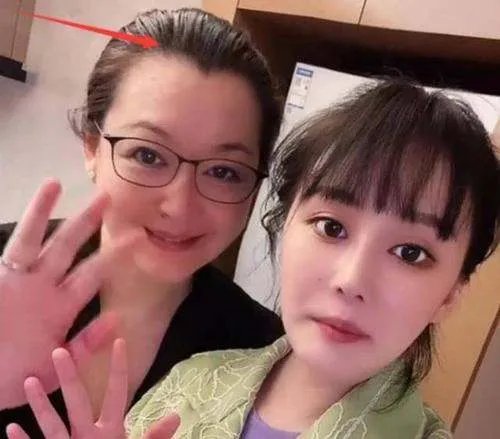 赵本山妻子谈女儿整容，坦言看着很揪心，女儿整容她该不该阻止？