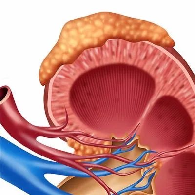 肾癌的治疗方法有哪些