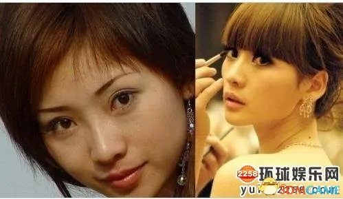 柳岩公开承认整过容打过瘦脸针 因影响做表情弃用