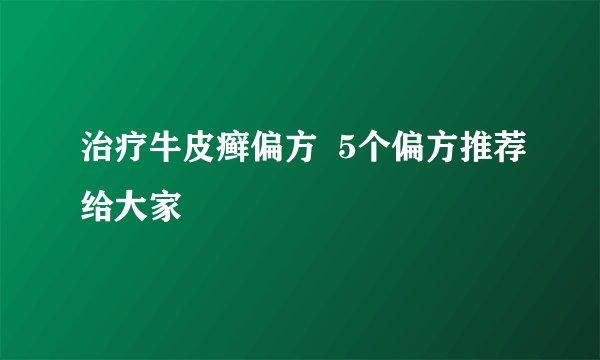 治疗牛皮癣偏方  5个偏方推荐给大家