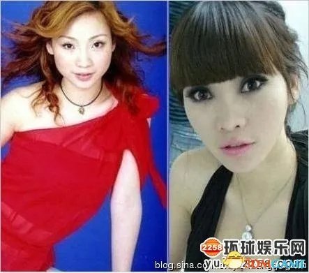 柳岩公开承认整过容打过瘦脸针 因影响做表情弃用