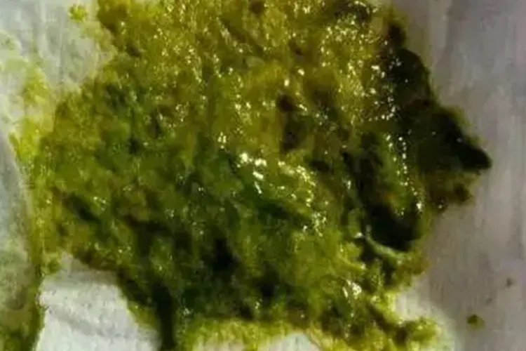 11个月宝宝正常大便图