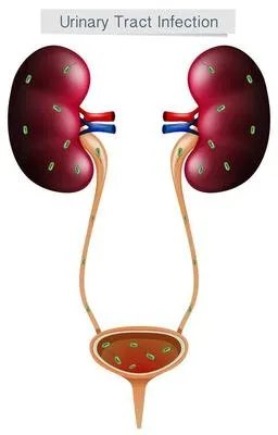 肾囊肿饮食注意事项有哪些