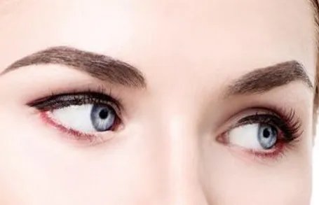 眼综合手术多久