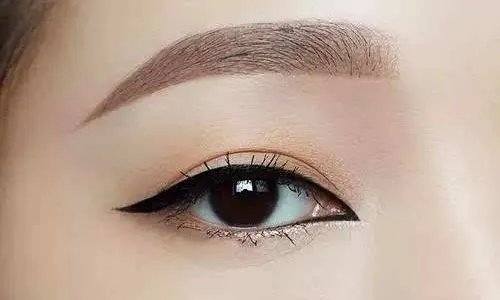 韩式无痕双眼皮的后遗症