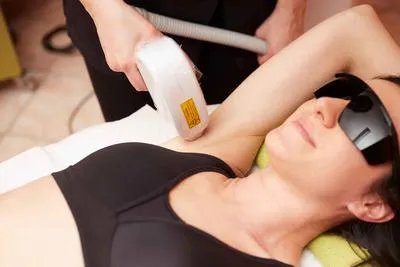 激光脱毛效果可以维持几年