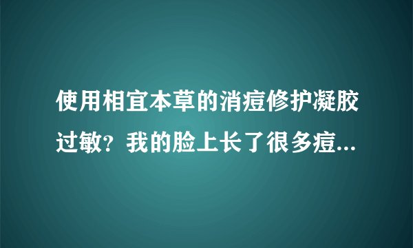 使用相宜本草的消痘修护凝胶过敏？我的脸上长了很多痘...