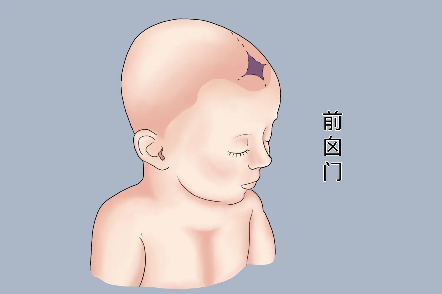 婴儿天门盖图片