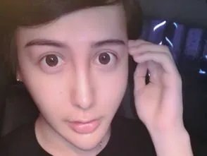 网红温精灵被吐槽整容失败，你还知道哪些整容失败的网红？