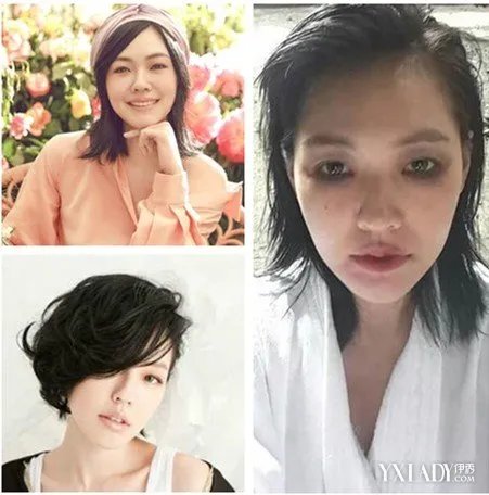 著名女星小s满脸淤青出镜备受热议网友们纷纷调侃又遭家暴了